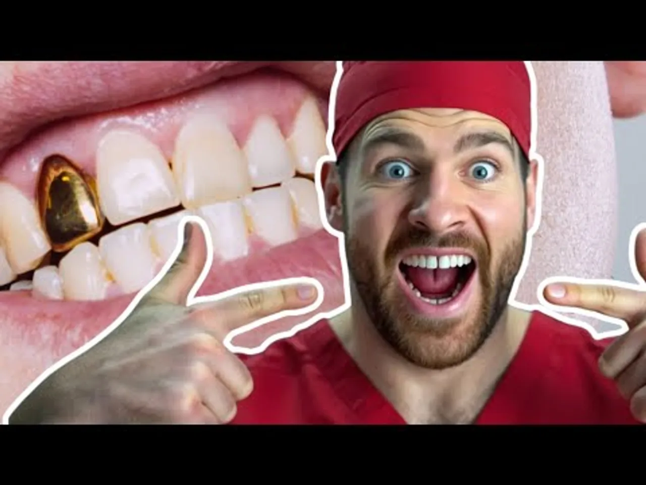 dent en or : tout savoir