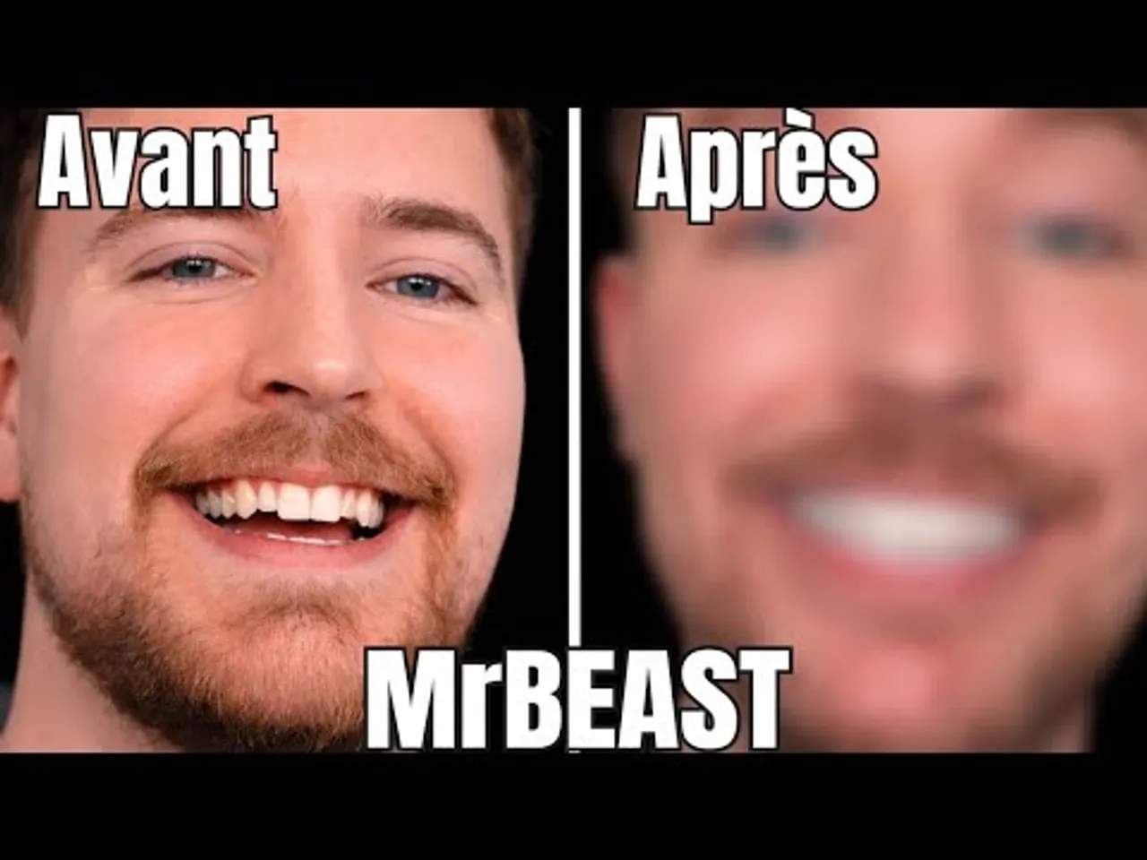 Pourquoi MrBeast a fait ça ? Son incroyable transformation enfin expliquée