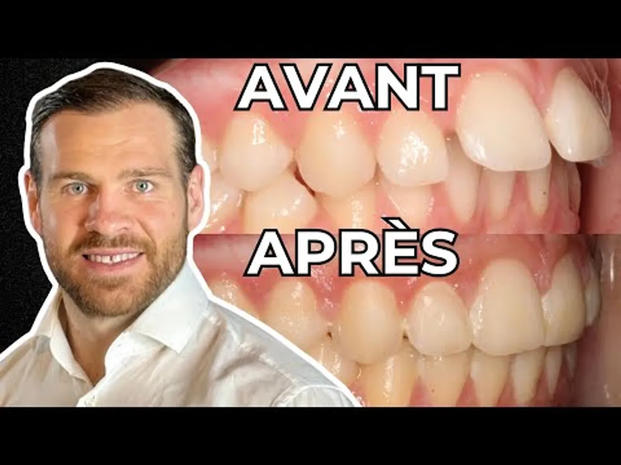 orthodontic treatment analysis