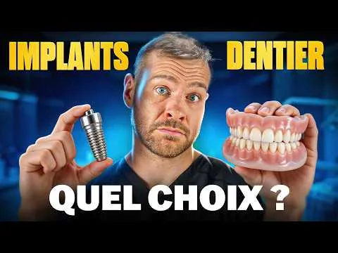 Implants VS Dentier : comment faire le bon choix ?